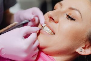 Cosa sapere prima di sottoporsi ad un trattamento di faccette dentali